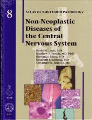 Non-Neoplastic Disorders of the Central Nervous System 