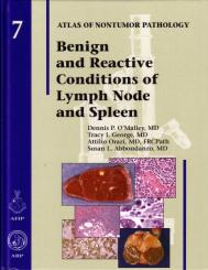Benign and Reactive Conditions of the Lymph Node and Spleen 
