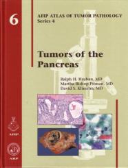Tumors of the Pancreas 