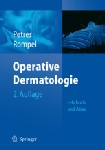 Operative Dermatologie 