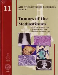 Tumors of the Mediastinum 