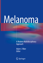 Melanoma 