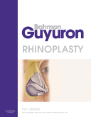Rhinoplasty 