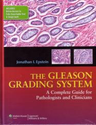 The Gleason Grading System 