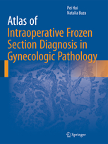 Atlas of Intraoperative Frozen Section Diagnosis in Gynecologic Pathology 
