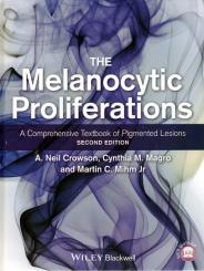 The Melanocytic Proliferations 