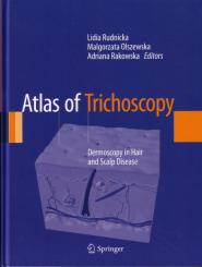 Atlas of Trichoscopy 