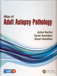 Atlas of Adult Autopsy Pathology 