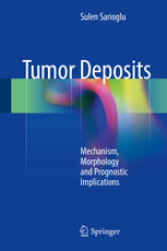 Tumor Deposits 