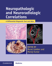 Neuropathologic and Neuroradiologic Correlations 