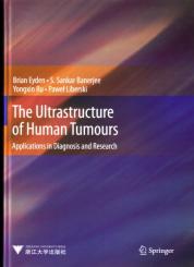 The Ultrastructure of Human Tumours 