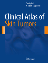 Clinical Atlas of Skin Tumors 
