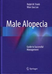 Male Alopecia 