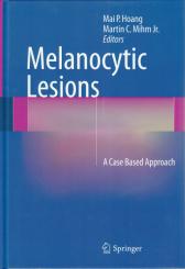 Melanocytic Lesions 