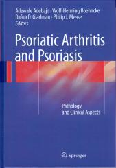 Psoriatic Arthritis and Psoriasis 
