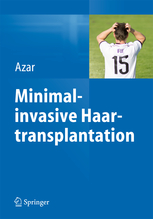 Minimalinvasive Haartransplantation 