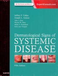 Dermatological Signs of Systemic Disease 