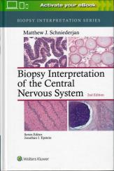 Biopsy Interpretation of the Central Nervous System 