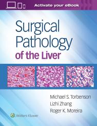 Surgical Pathology of the Liver 