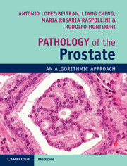 Pathology of the Prostate 