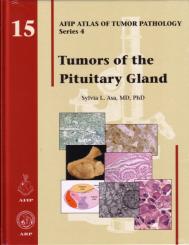 Tumors of the Pituitary Gland 