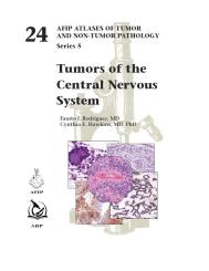 Tumors of the Central Nervous System 