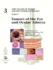 Tumors of the Eye and Ocular Adnexa 