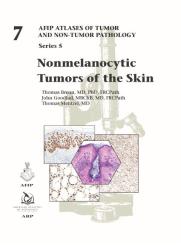 Nonmelanocytic Tumors of the Skin 