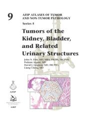 Tumors of the Kidney, Bladder, and Related Urinary Structures 