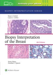 Biopsy Interpretation of the Breast 