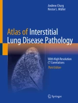 Atlas of Interstitial Lung Disease Pathology 