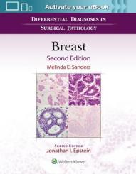 Differential Diagnoses in Surgical Pathology: Breast 