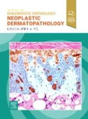 Diagnostic Pathology: Neoplastic Dermatopathology 