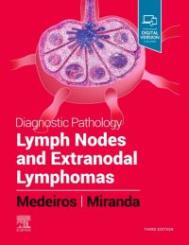 Diagnostic Pathology: Lymph Nodes and Extranodal Lymphomas 