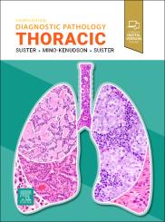 Diagnostic Pathology: Thoracic 