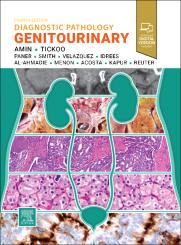 Diagnostic Pathology: Genitourinary 