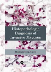 Histopathologic Diagnosis of Invasive Mycoses 