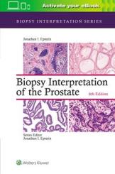 Biopsy Interpretation of the Prostate 