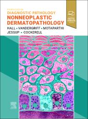 Diagnostic Pathology: Nonneoplastic Dermatopathology 