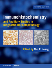 Immunohistochemistry and Ancillary Studies in Diagnostic Dermatopathology 