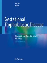 Gestational Trophoblastic Disease 