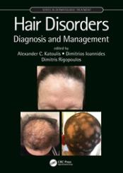 Hair Disorders 