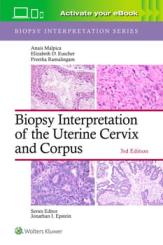 Biopsy Interpretation of the Uterine Cervix and Corpus 