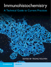 Immunohistochemistry 