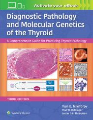 Diagnostic Pathology and Molecular Genetics of the Thyroid 