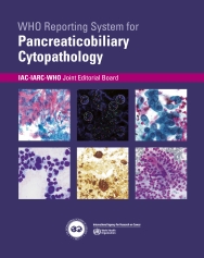 WHO Reporting System for Pancreaticobiliary Cytopathology 