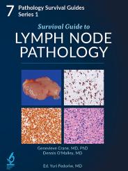 Survival Guide to Lymph Node Pathology 
