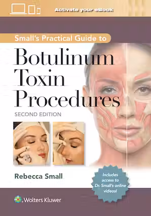 A Practical Guide to Botulinum Toxin Procedures 