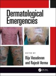 Dermatological Emergencies 