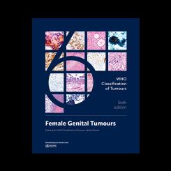 WHO Classification of Tumours: Female Genital Tumours 